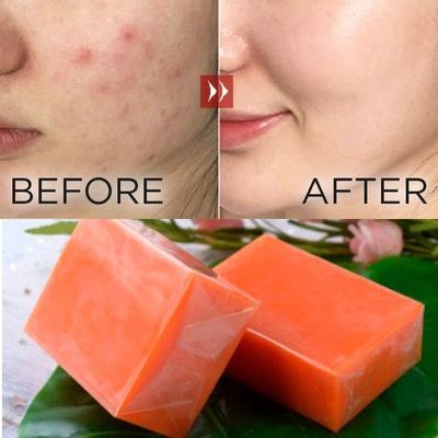 Vagina Strengthening en Detox Yoni Whitening Soap Bar NO Medicated 2 jaar houdbaarheid