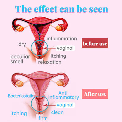 Vaginale verzorgingsproducten voor de gezondheid van vrouwen Functie Vernauwing van de vagina 2 jaar houdbaarheid